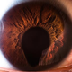 Illustration for article titled Why do some people's eyes look like keyholes?